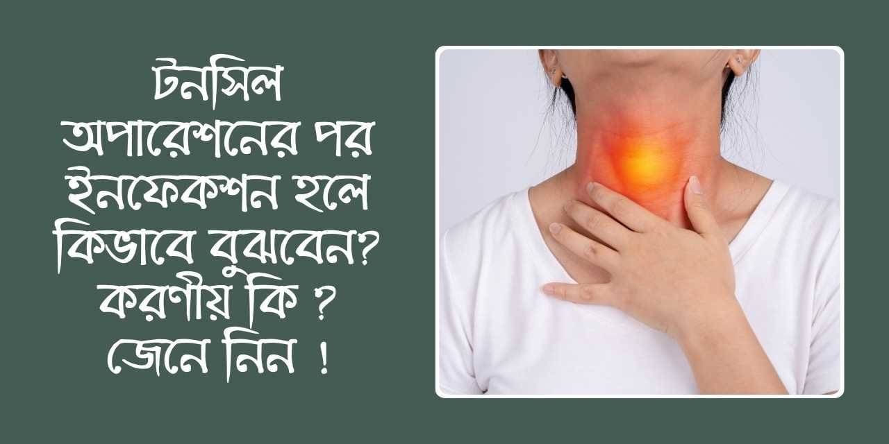 টনসিল অপারেশনের পর ইনফেকশন হলে কিভাবে বুঝবেন? করণীয় কি ? জেনে নিন !