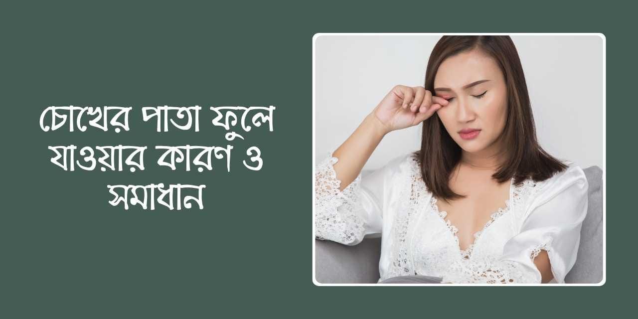 চোখের পাতা ফুলে যাওয়ার কারণ ও সমাধান
